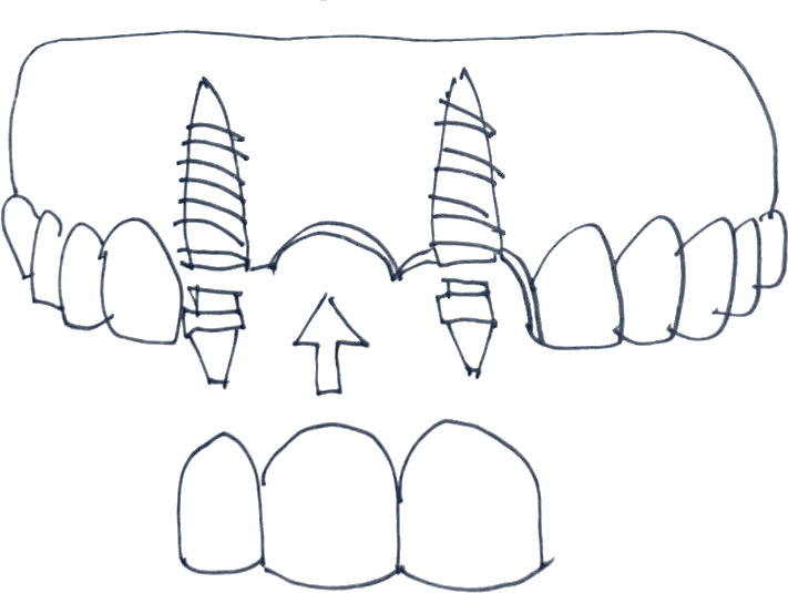 Esquema de rehabilitación múltiple